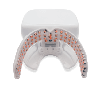 A white device with a curved, transparent mouthpiece lined with small red LED lights, likely used for dental treatments—ideal for brand marketing campaigns focused on innovative oral care solutions.